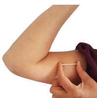 Information about contraceptive implant – Thornfield Medical Group